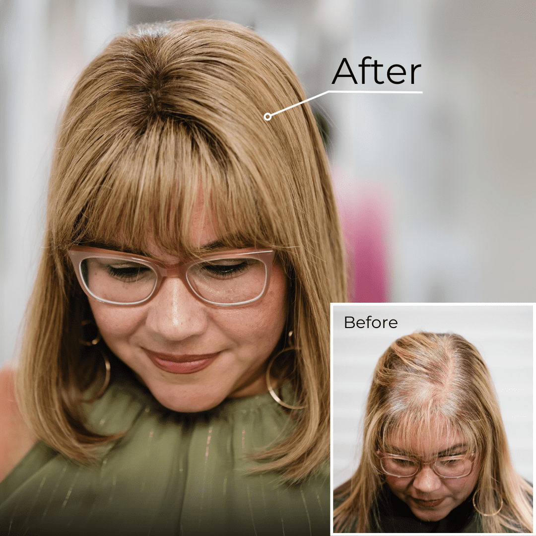 Hair System - Non-Surgical Hair Replacement Results