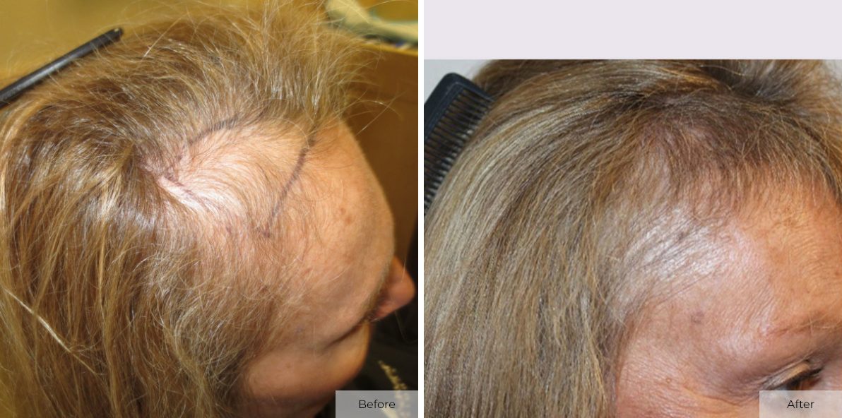 Cindy Hulen - Before & After - Image 2