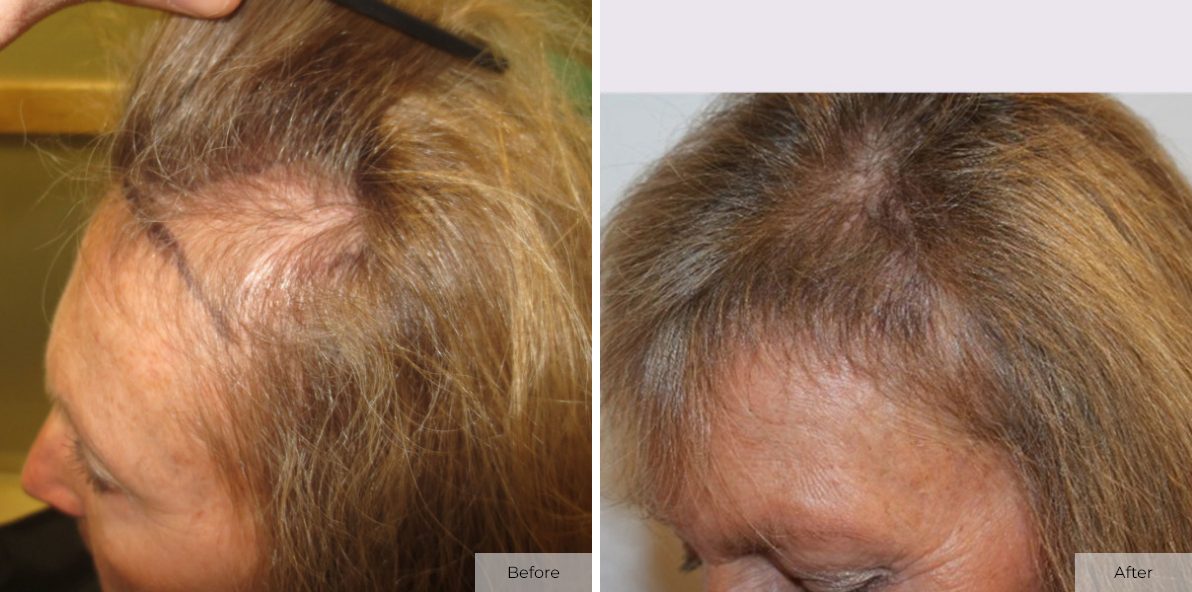 Cindy Hulen - Before & After - Image 3