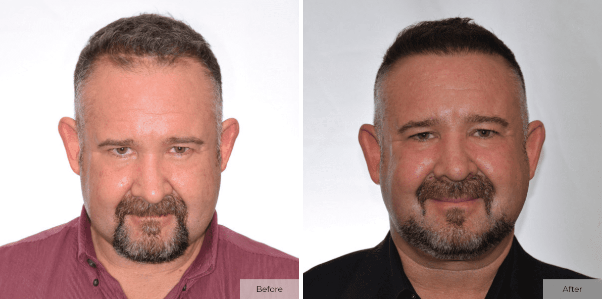 Jason Richey - Before & After - Image 1