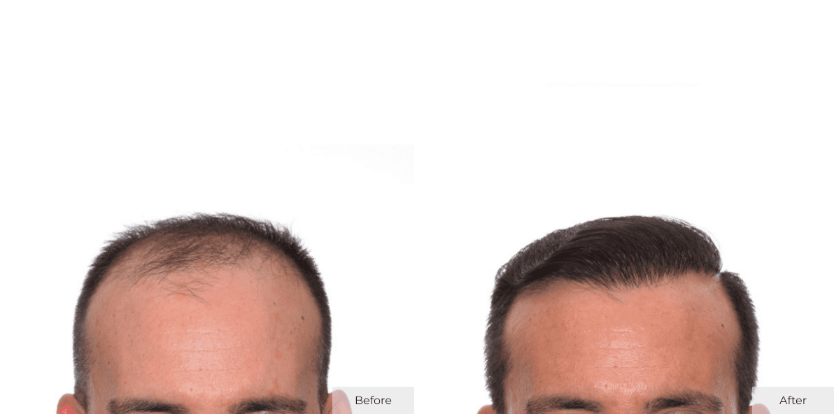 Joe Bergen - Before- Before & After - Image 2