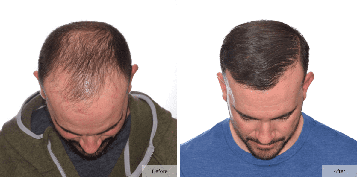 Joe Bergen - Before- Before & After - Image 3