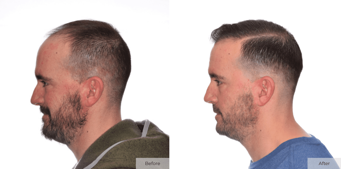 Joe Bergen - Before- Before & After - Image 4