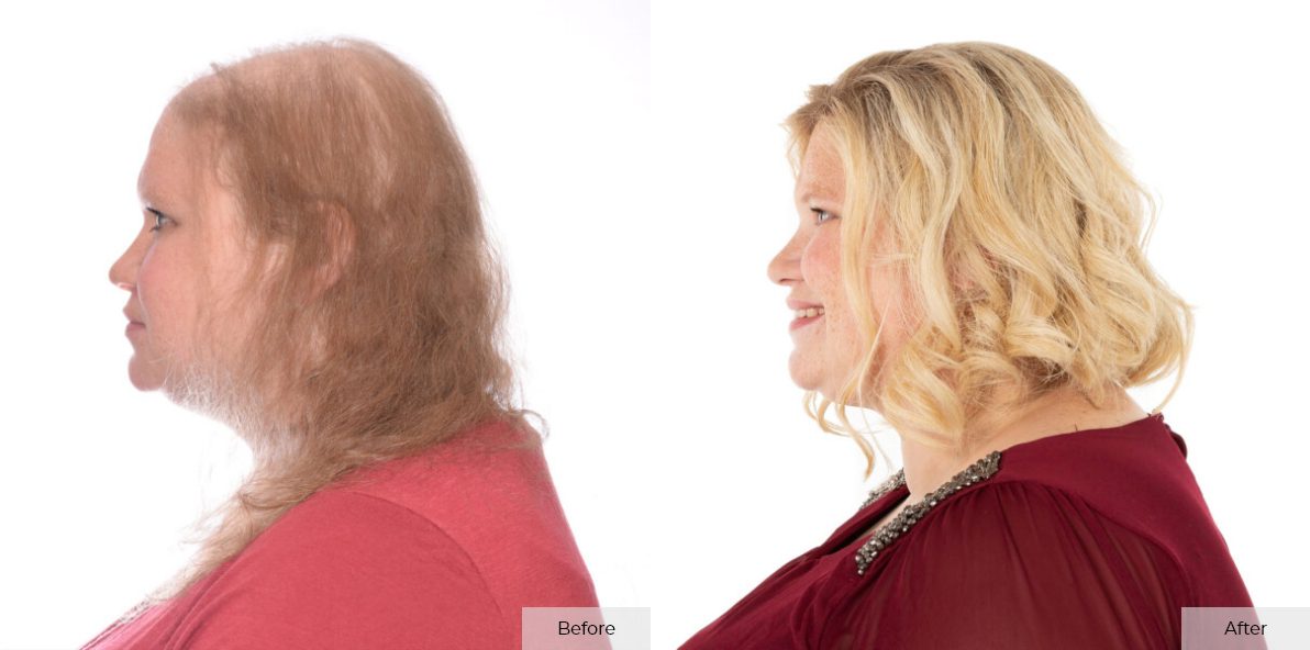Katelyn Gibbens- Before & After - Image 4 – 1