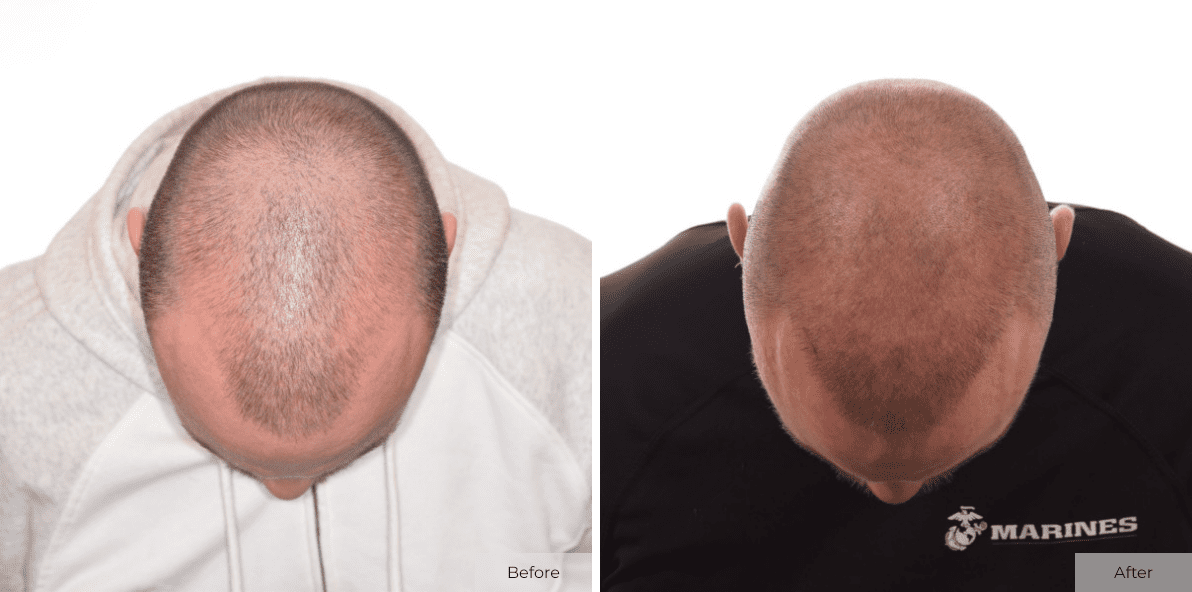 Kyler White - Before & After - Image 2