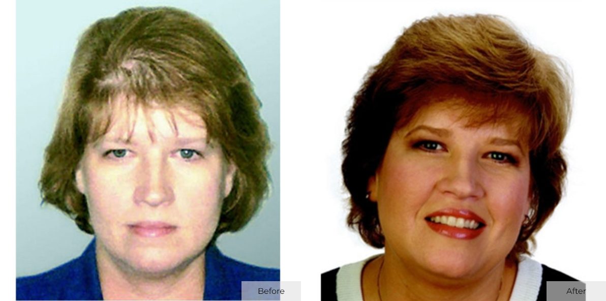 Lisa C- Before & After - Image 1