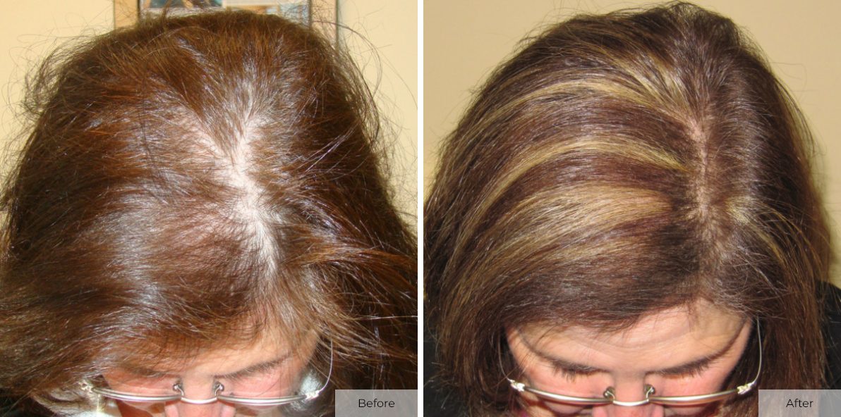 Patient 13 - Before & After - Image 1