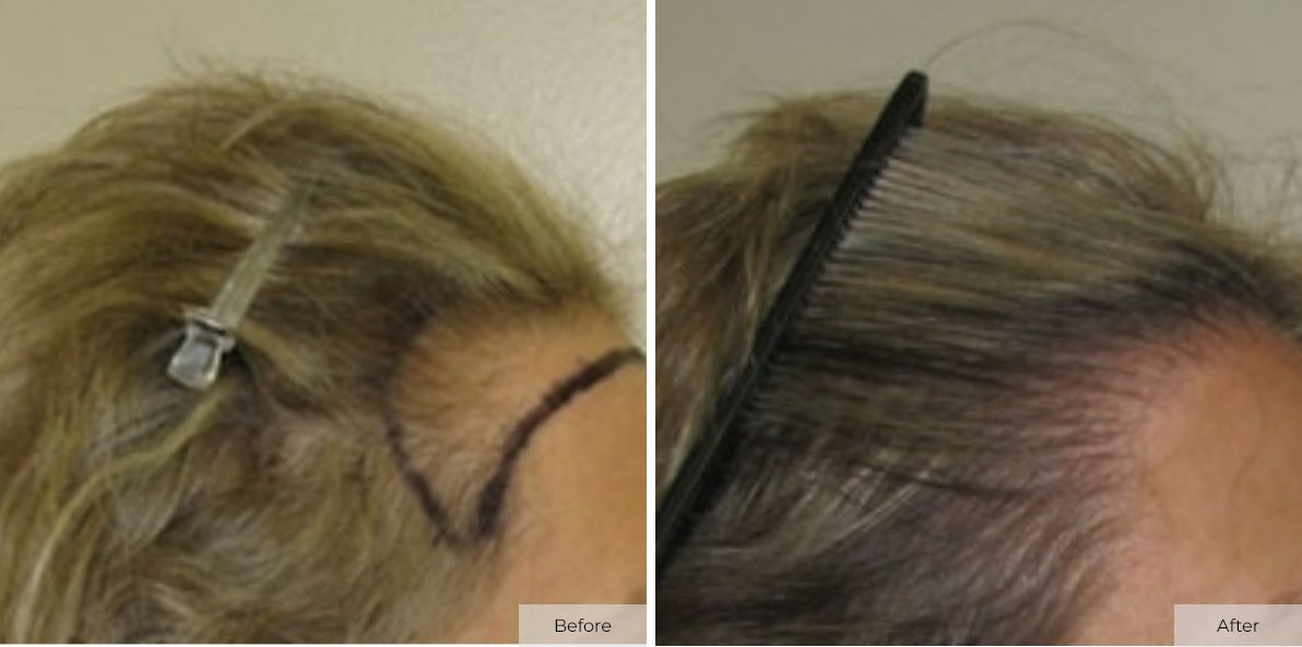 Patient 15 - Before & After - Image 1