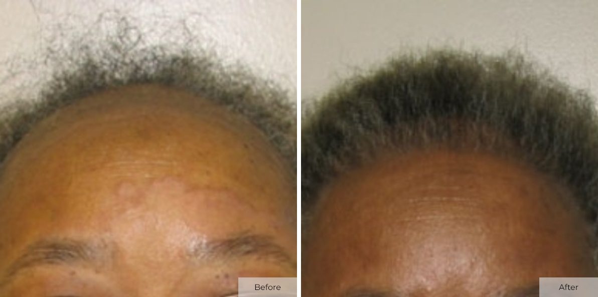 Patient 26 - Before & After - Image 1