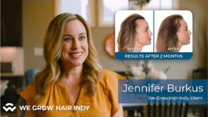 Jennifer Burkus Testimony - Non-Surgical Hair Treatments at We Grow Hair Indy