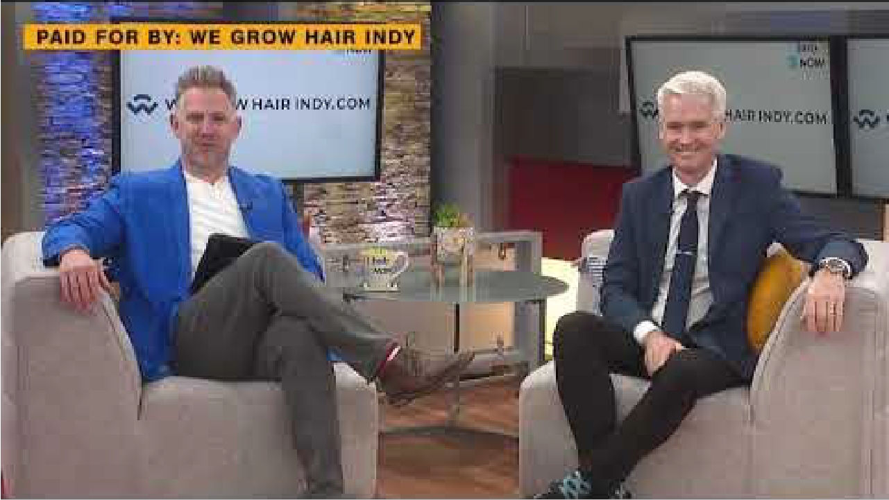 Fox 59 Indy Now - Hair Transplant Results at We Grow Hair Indy - Dave Furst's 4 Month Results!