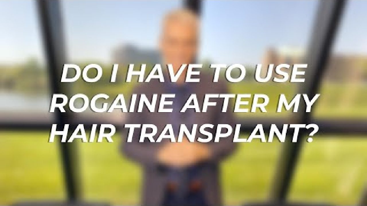 Do I Have To Use Rogaine After My Hair Transplant?