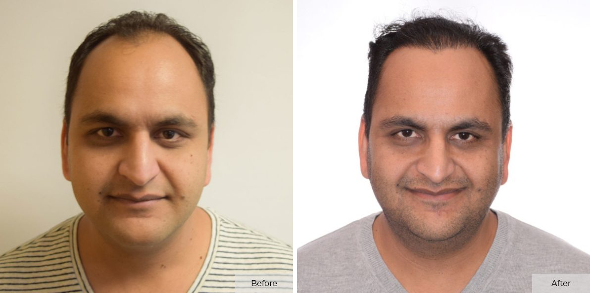 Faisal Khan - Before & After 2 – 37