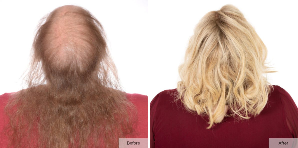 Katelyn Gibbens- Before & After - Image 1 – 2 (1)