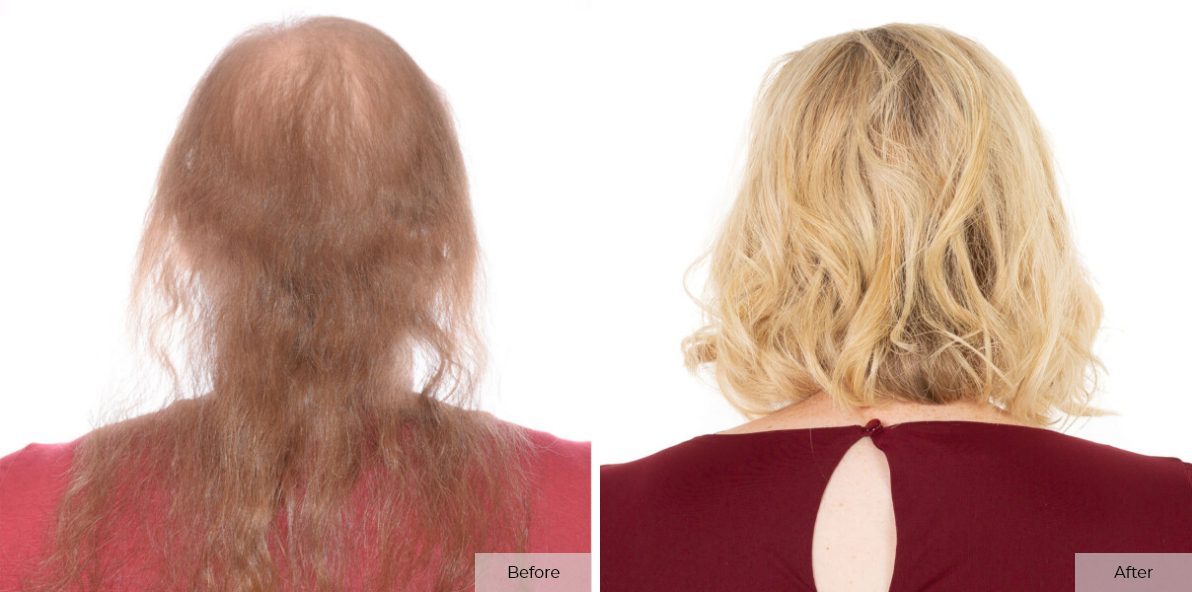Katelyn Gibbens- Before & After - Image 2 – 2 (1)
