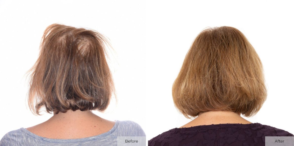 Marleen Signer - Before & After - Image 1 – 22