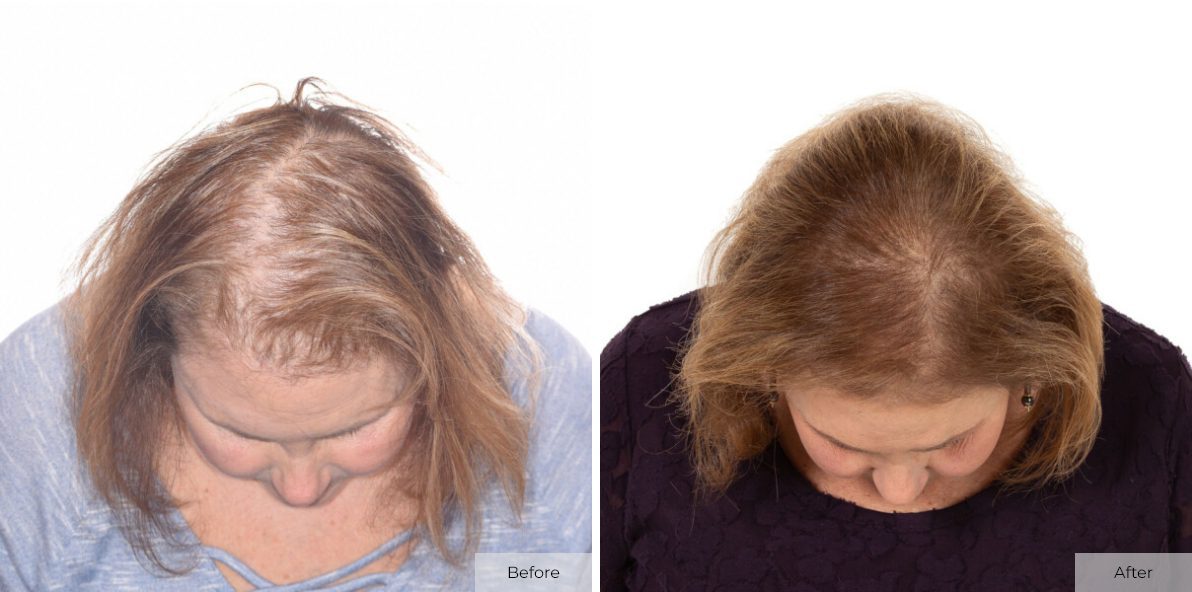 Marleen Signer - Before & After - Image 1 – 27