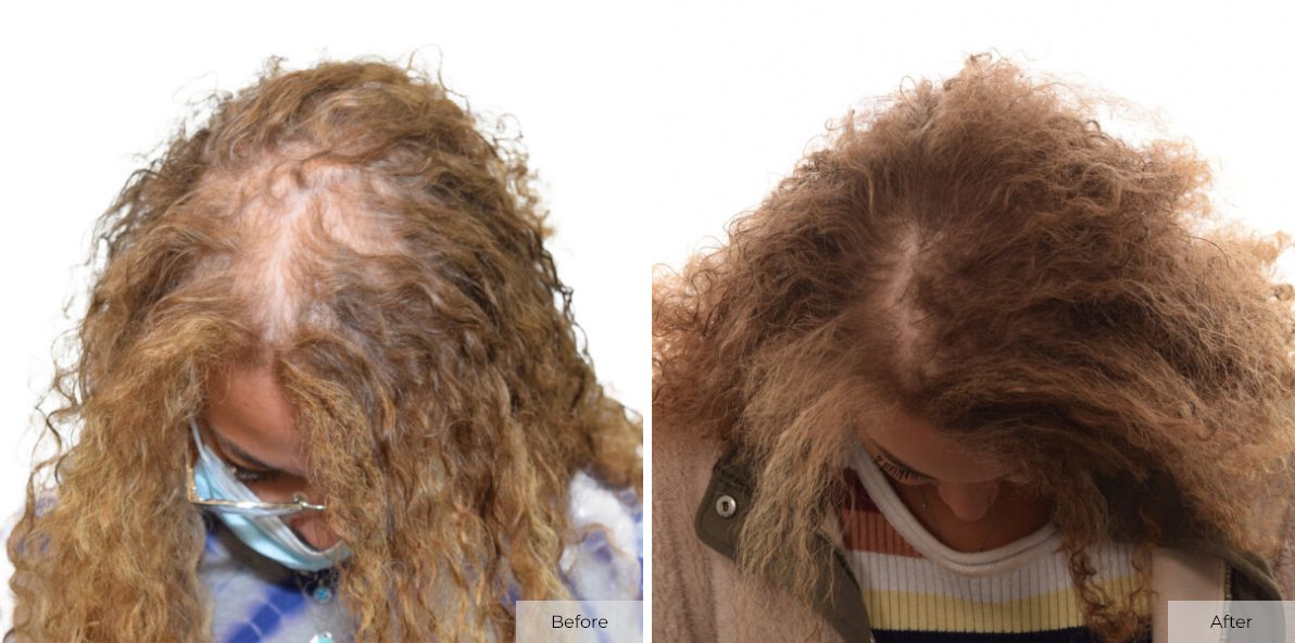 Mikaela Jordan - Before & After - Image 1 – 17