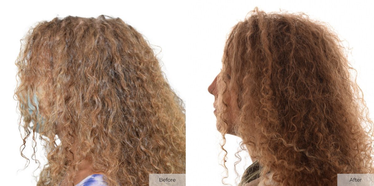 Mikaela Jordan - Before & After - Image 1 – 20