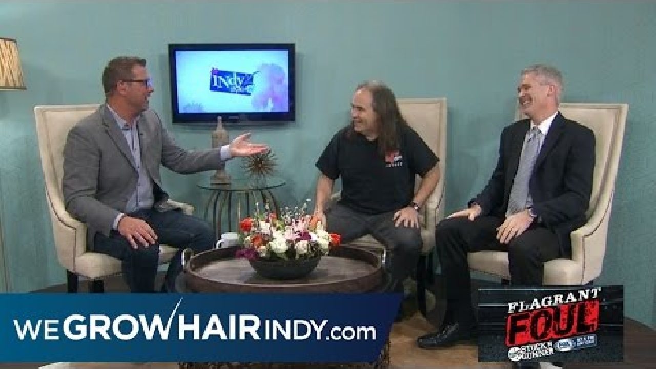 Pre Hair Transplant | IndyStyle Feat. 97.5FM Don Stuck from Stuck & Gunner