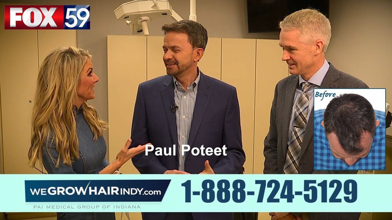 Hair Transplant 6 Month UPDATE | Paul Poteet Fox 59