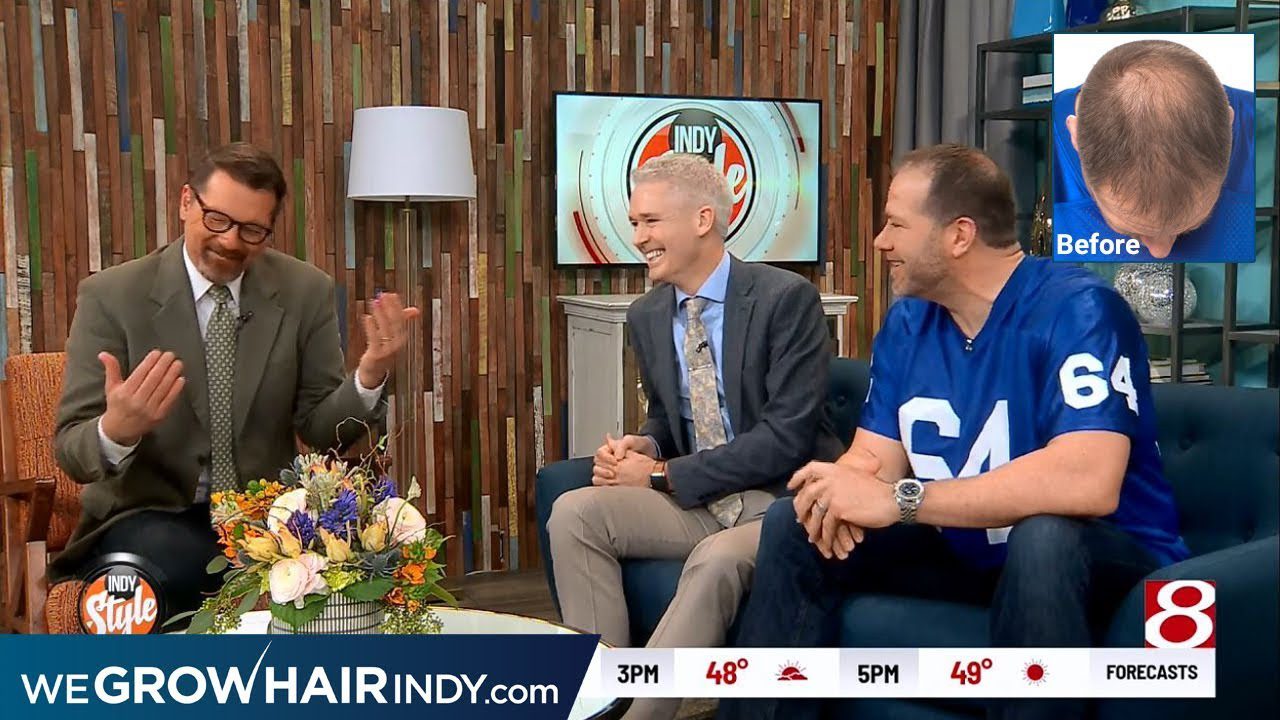 Tackling Hair Loss! – Rick DeMulling on WISHTV Indy Style