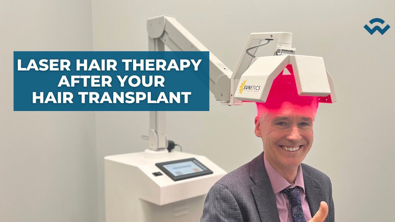The Importance of Laser Hair Therapy After A Hair Transplant