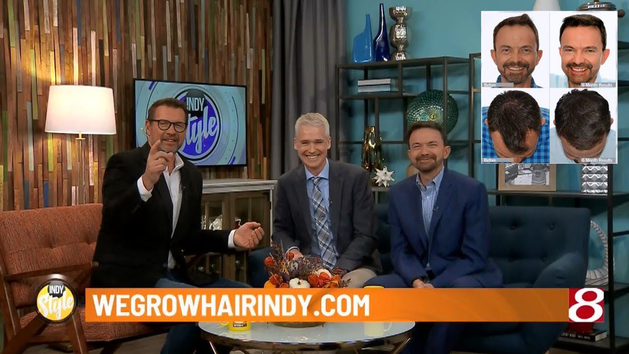 Hair Transplant Update | Paul Poteet on WISH-TV Indy Style