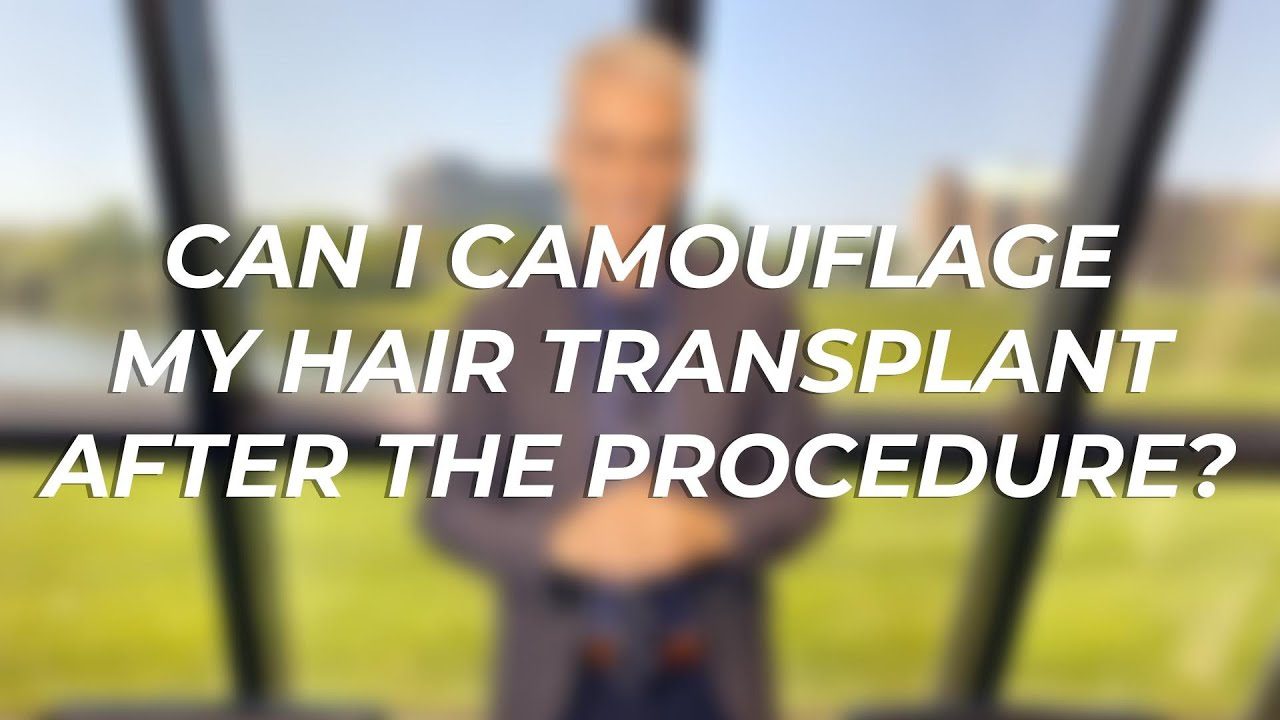 Can I Camouflage My Hair Transplant After The Procedure?