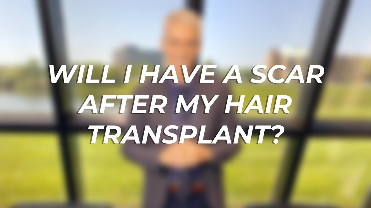 Will I Have A Scar After A Hair Transplant?