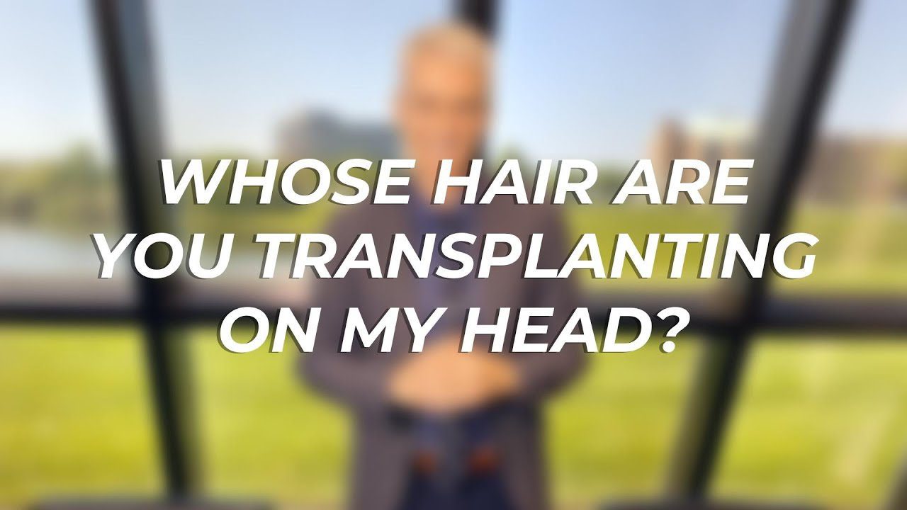 Whose Hair Are You Transplanting On My Head?
