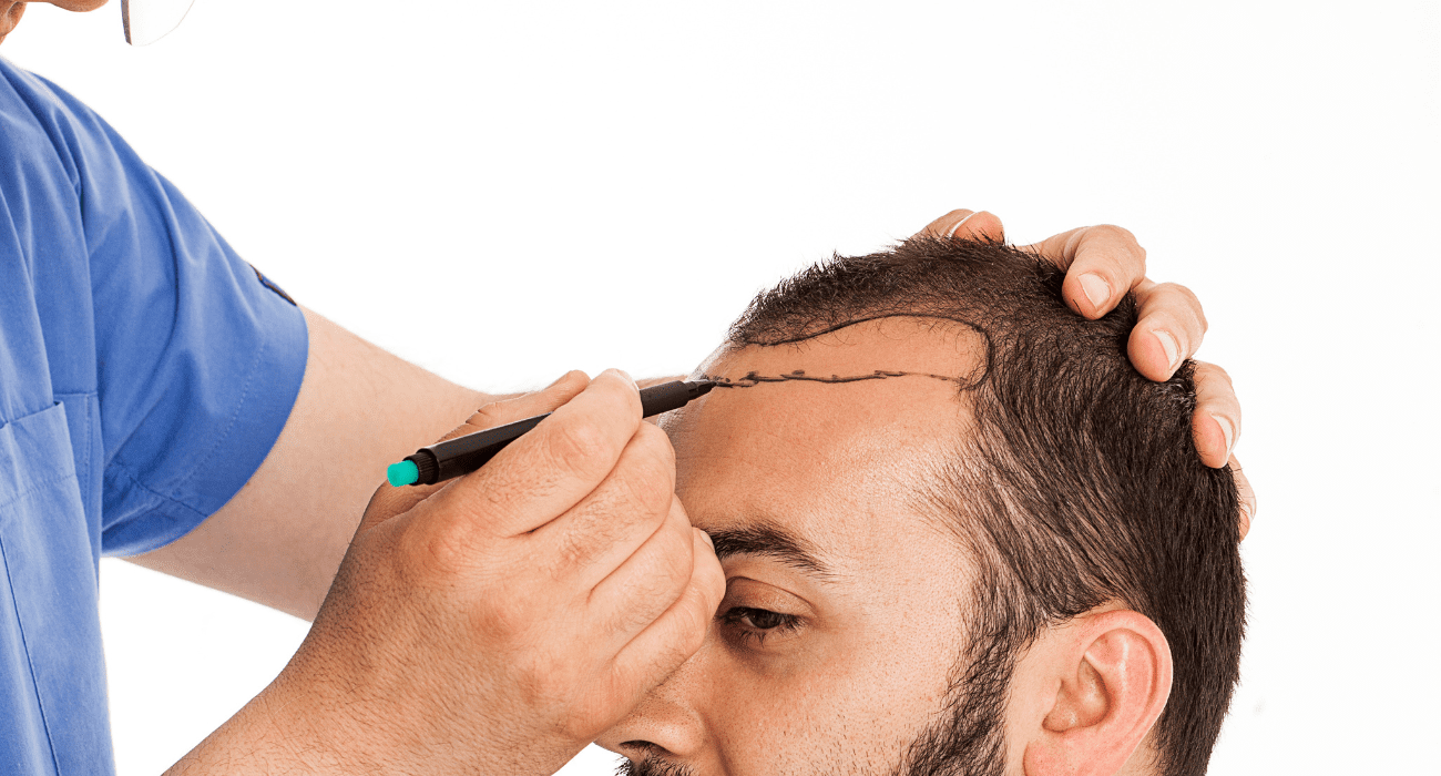the risk of getting a hair transplant in turkey