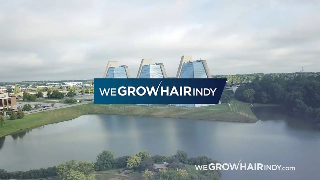 We Grow Hair Indy I Indianapolis Hair Restoration Specialists