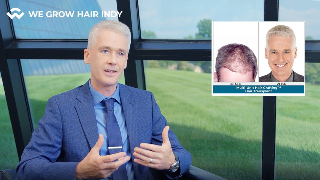 We Grow Hair Indy I Innovative & Proven Hair Restoration Solutions