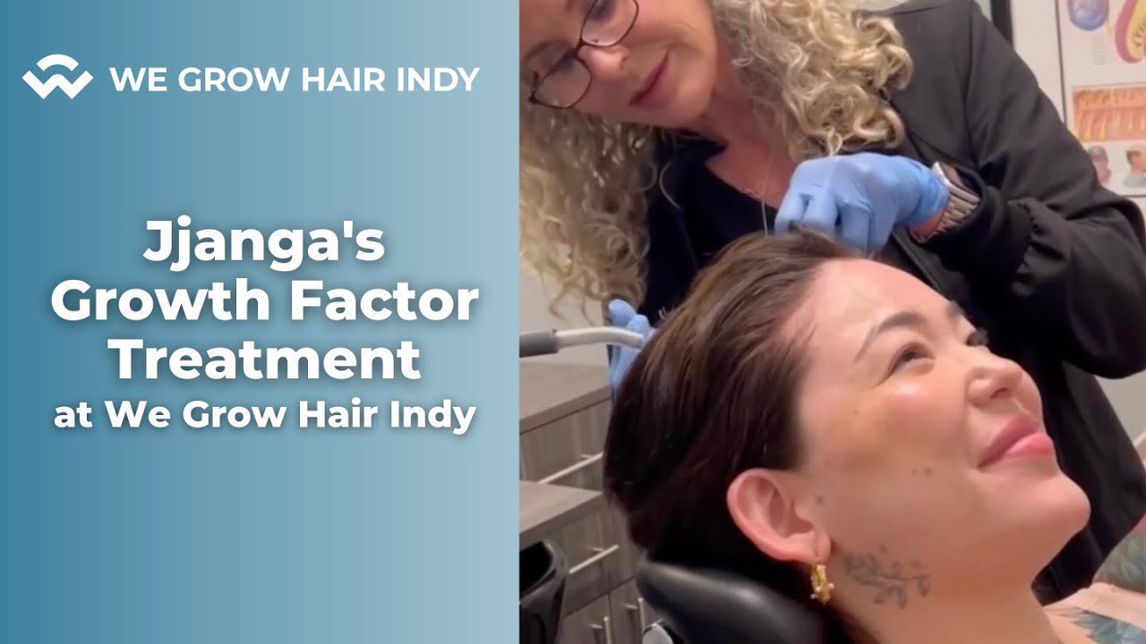 Hair Loss Treatments for women JJanga