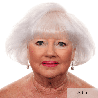 Lois Johnson Treatment After