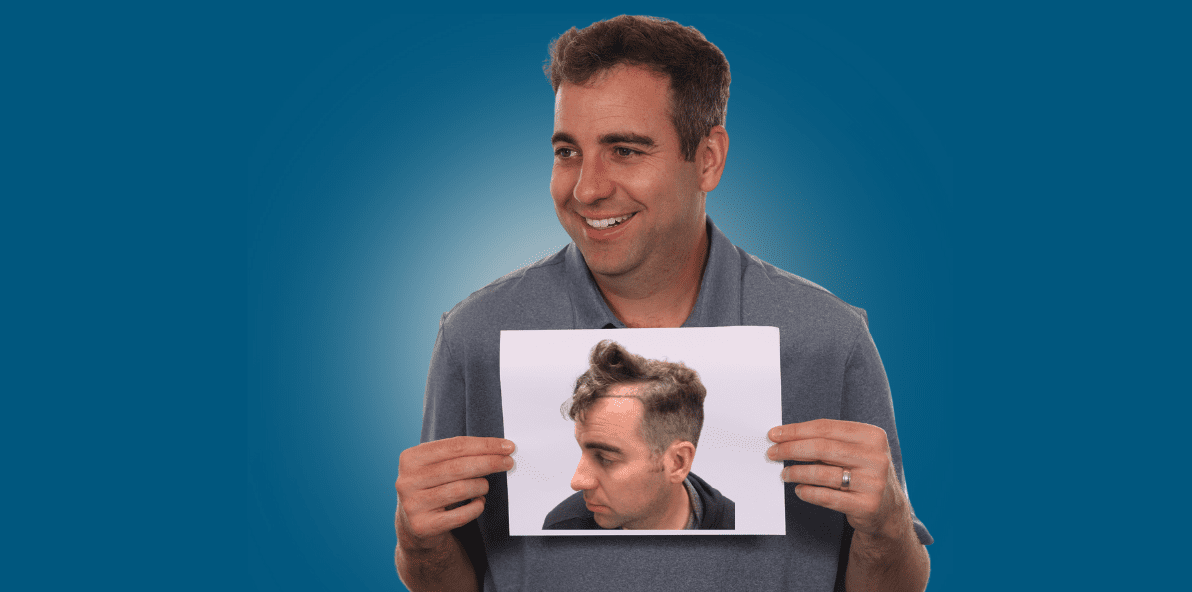 WP Popup Template Hair Transplant B&A (1)