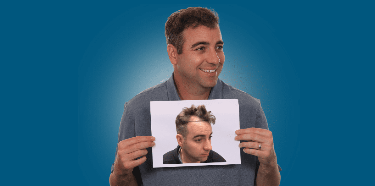 WP Popup Template Hair Transplant B&A (2)