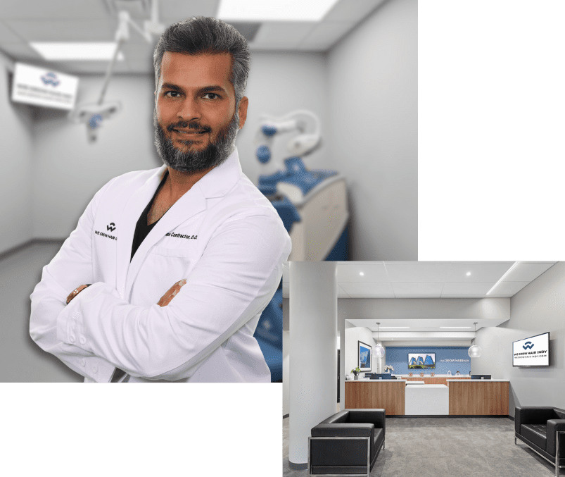 Dr Contractor Hair Transplant