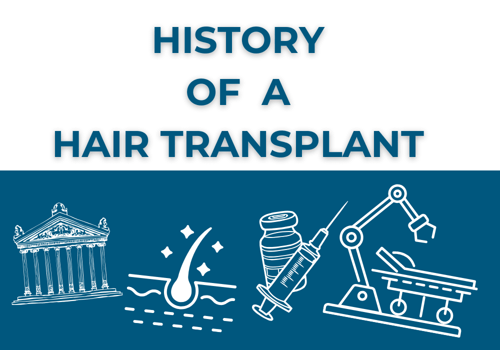 The History of Hair Transplants