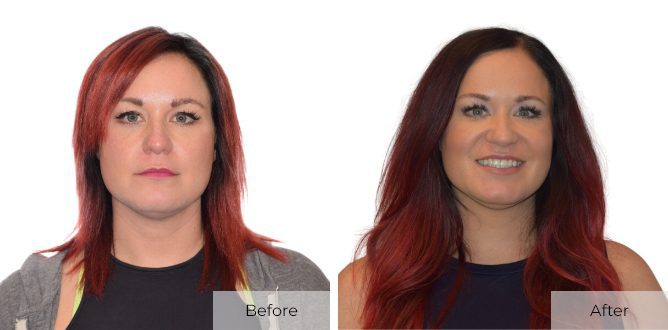 30-Days-After-Before-After-–-1-1.jpg