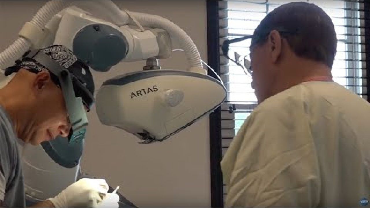 ARTAS Robotic FUE Hair Transplant