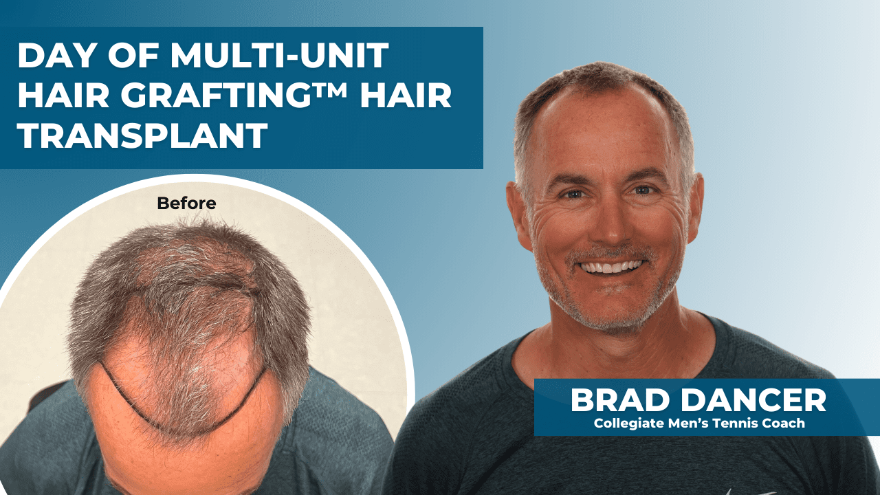 Brad Dancer: Day of Multi-Unit Hair Grafting™ Procedure