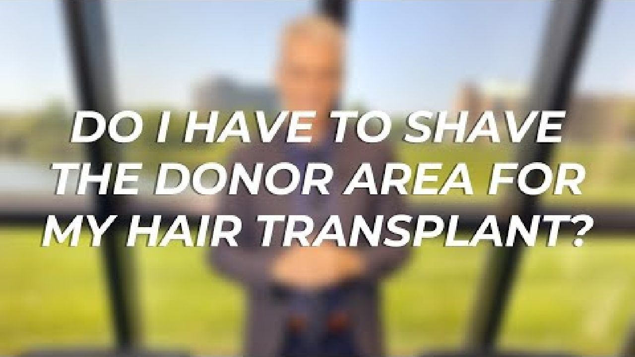 Do I Have To Shave The Donor Area For My Hair Transplant?