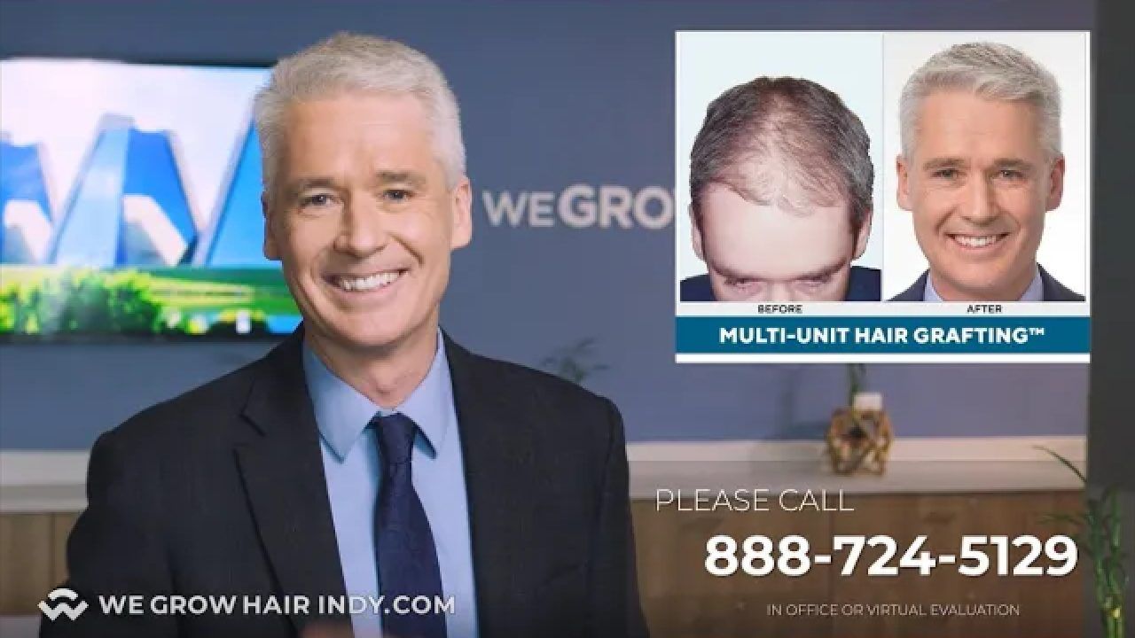 Gold Standard in Hair Restoration