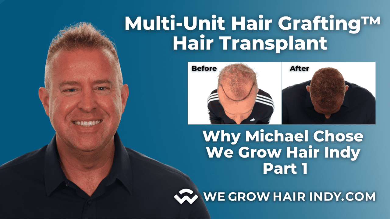 Why Michael Chose We Grow Hair Indy