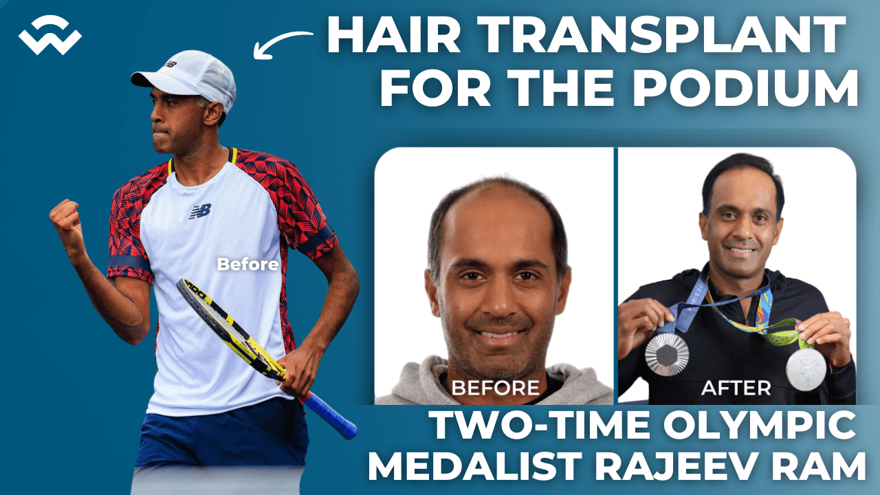 Olympian Rajeev Ram Got a Hair Transplant for the Podium