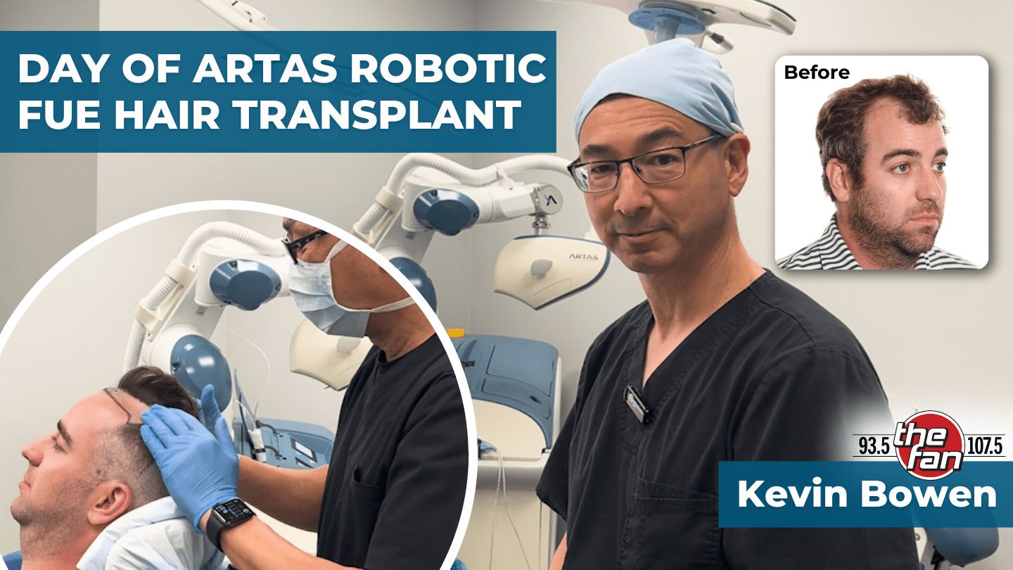 Watch an ARTAS Robotic FUE Hair Transplant - VIP Kevin Bowen Day of Procedure