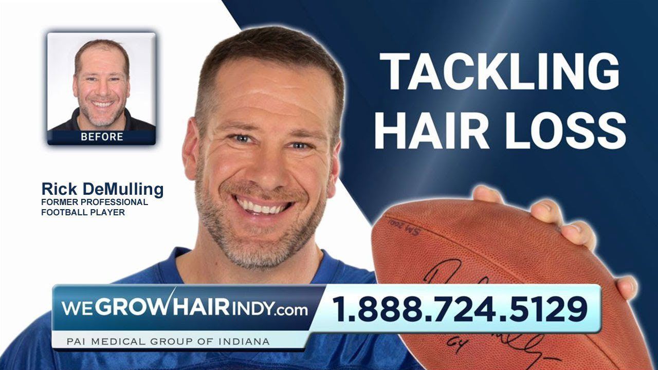 JMV & Rick DeMulling Are Tackling Hair Loss!