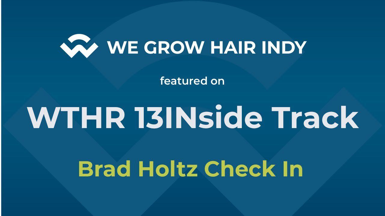 Brad Holtz Check In 4 Months Post Hair Transplant with WTHR Inside Track